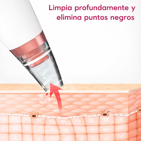 Succionador de poros