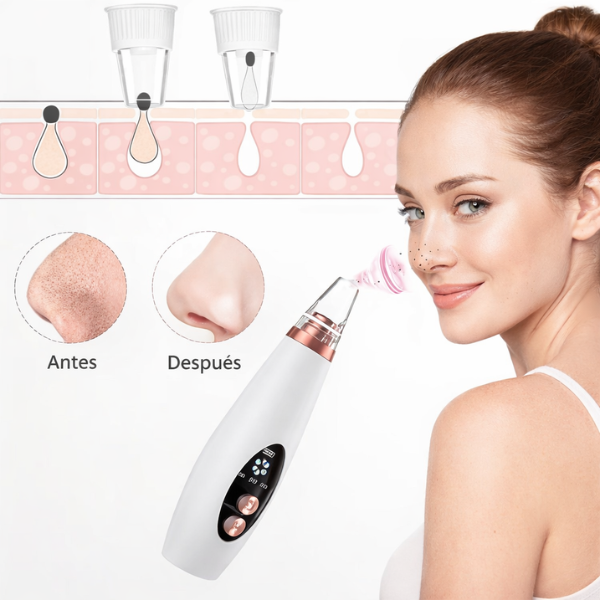 Succionador de poros